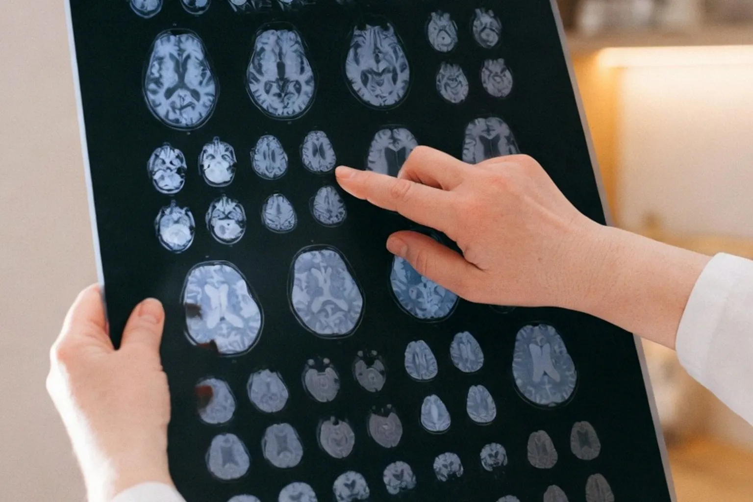 Más allá del diagnóstico convencional: cómo la IA detecta riesgos de cáncer antes de que aparezcan